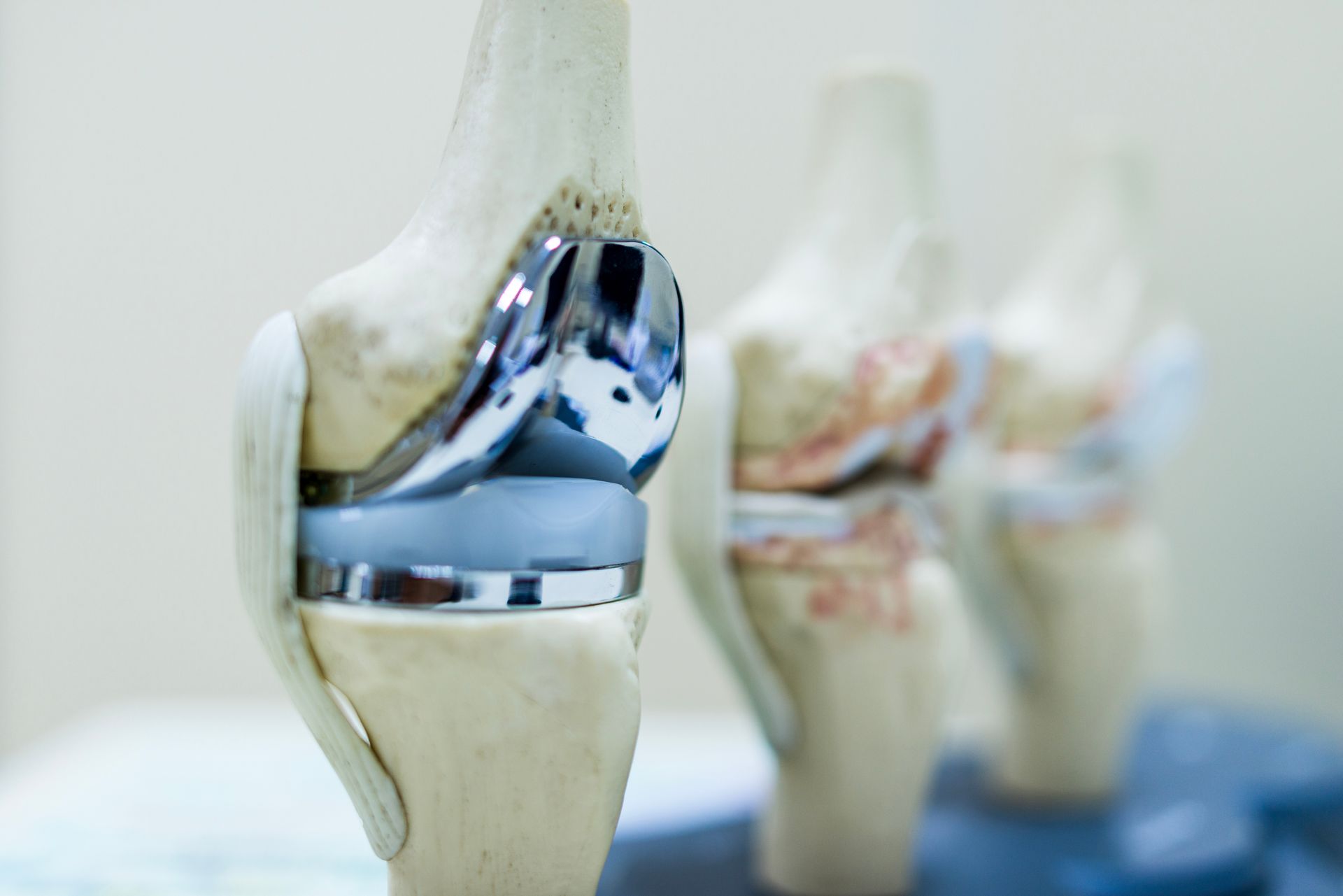 A close up of a model of a knee with a knee replacement.