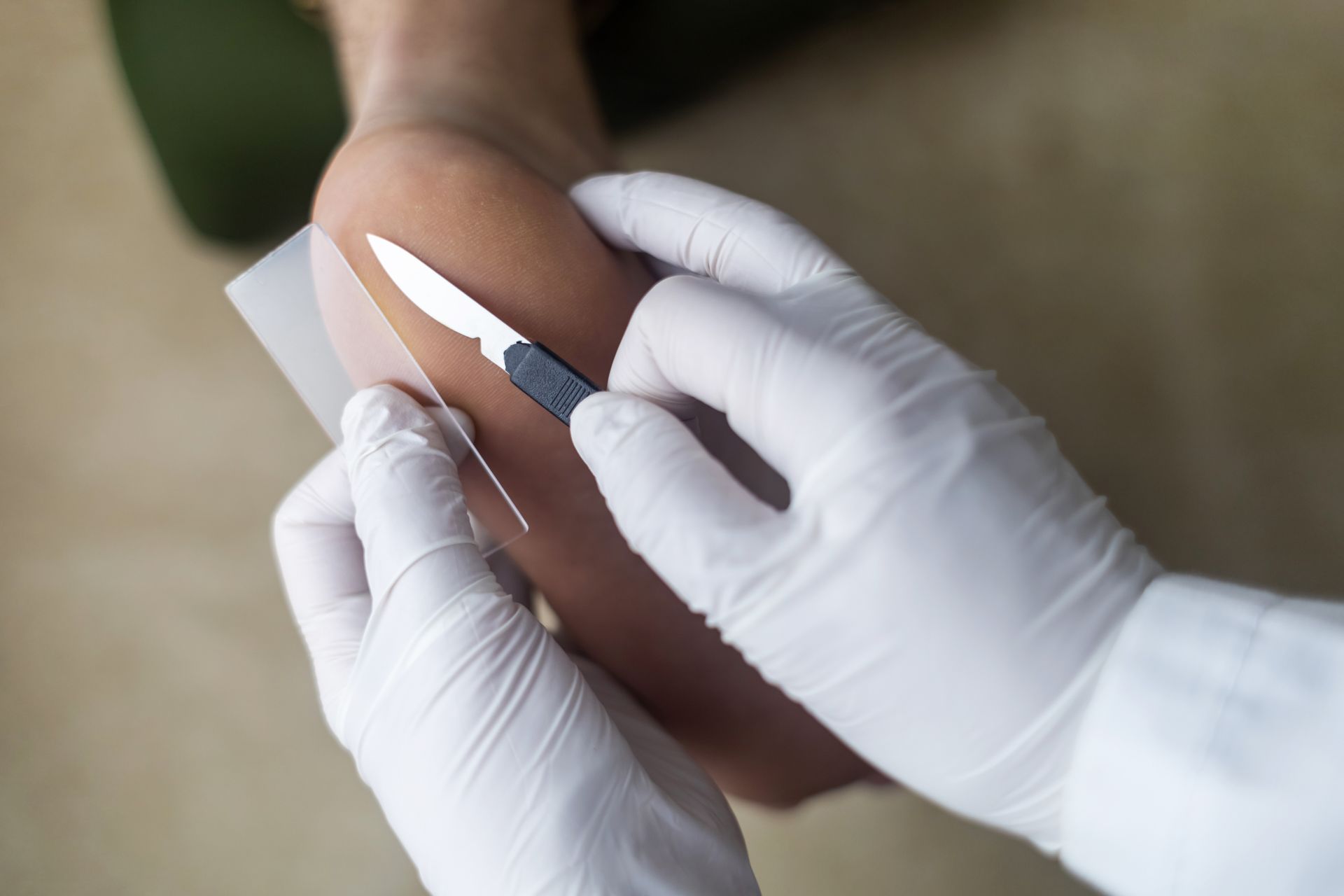 A person is holding a scalpel on their elbow.