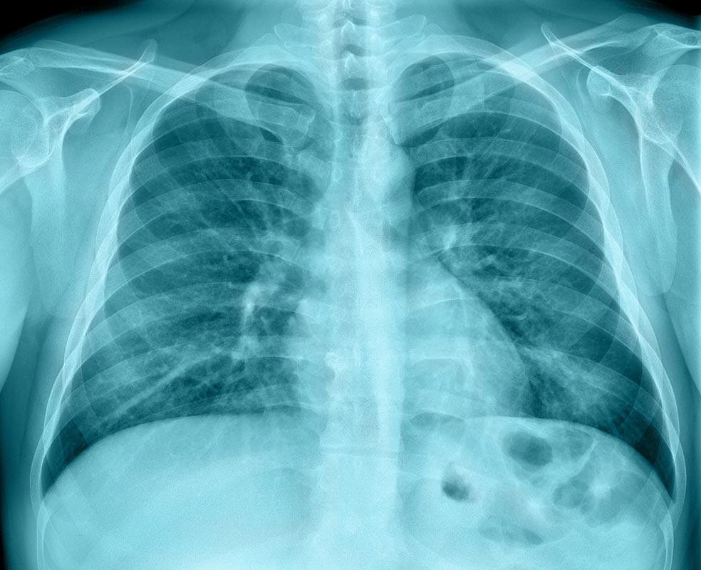 CALIDAD XXI-control de calidad de rayos x y venta de accesorios
