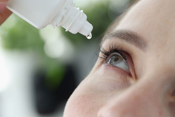Person administering eye drops, tilting head up. White bottle dispensing a clear liquid into open eye.