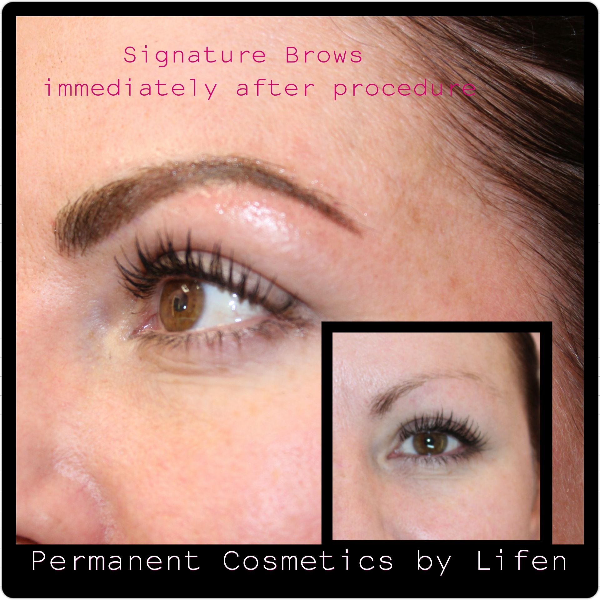A picture of a woman 's eyebrows with the caption signature brows immediately after procedure
