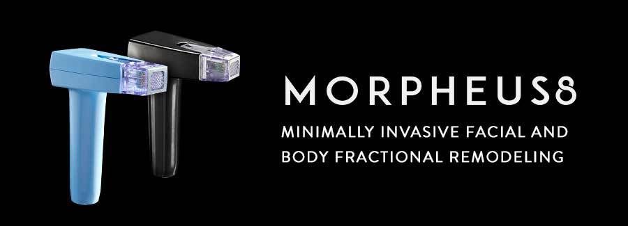 Morpheus8 minimally invasive facial and body fractional remodeling
