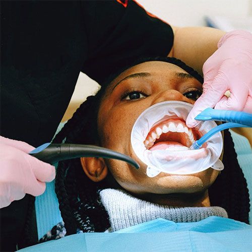 Crowns and Bridges — Epping, VIC — Dento Mak Dental Surgery