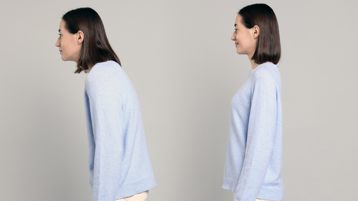 Woman demonstrating poor posture (left) and good posture (right) against a gray background.