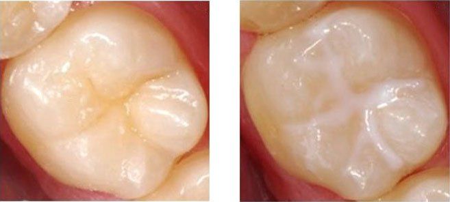 bambino dal dentista con modello di bocca