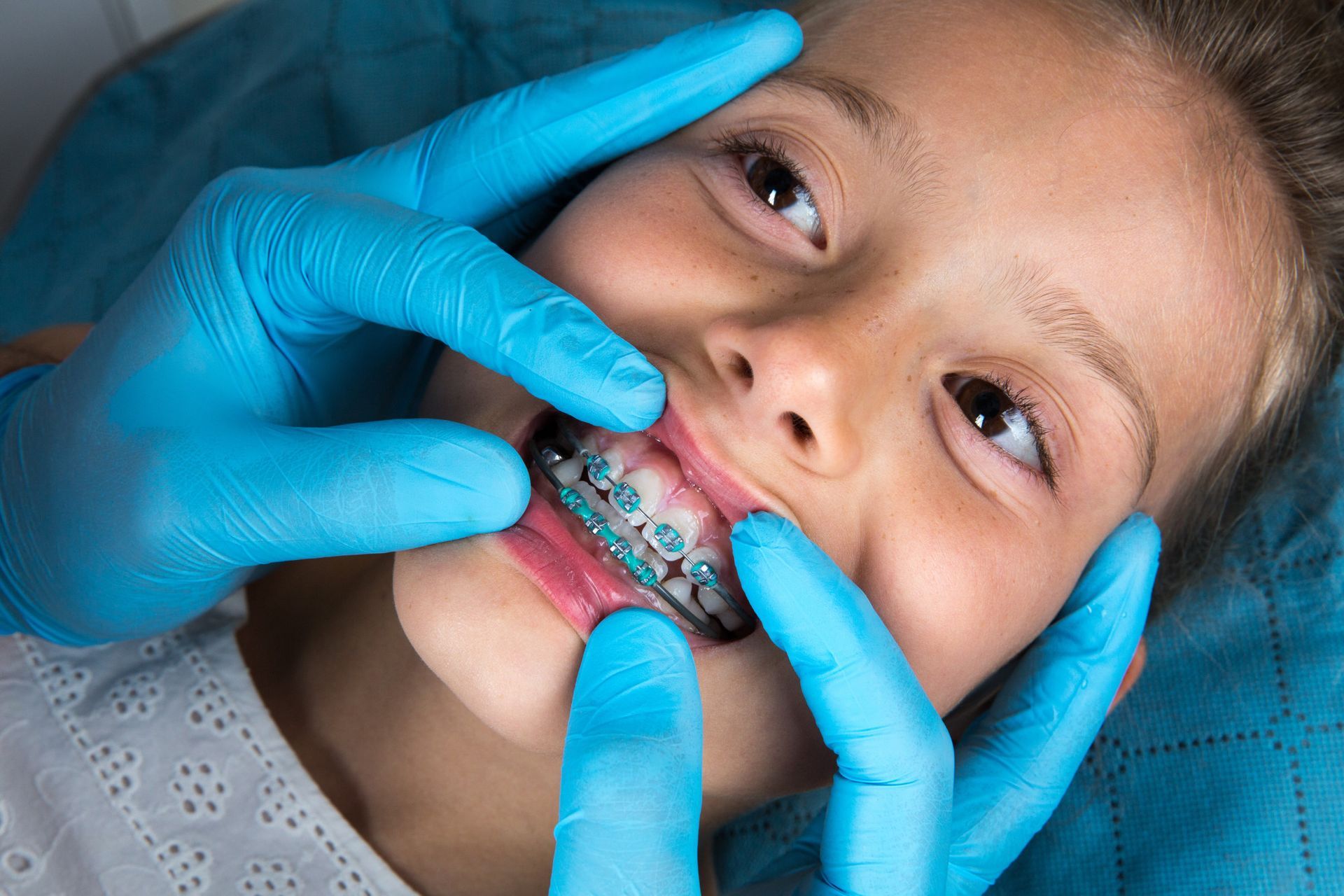 Orthodontist-examining-a-little-child