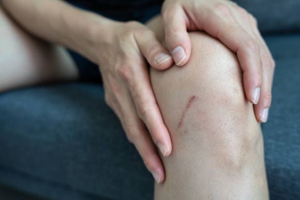 Scars | Tucson, AZ | OA