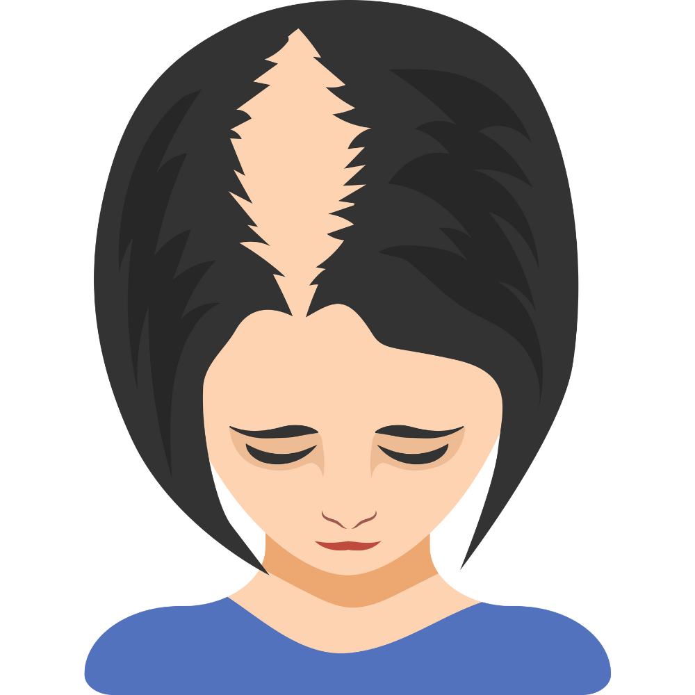 A cartoon illustration of a woman with a bald spot on her head.