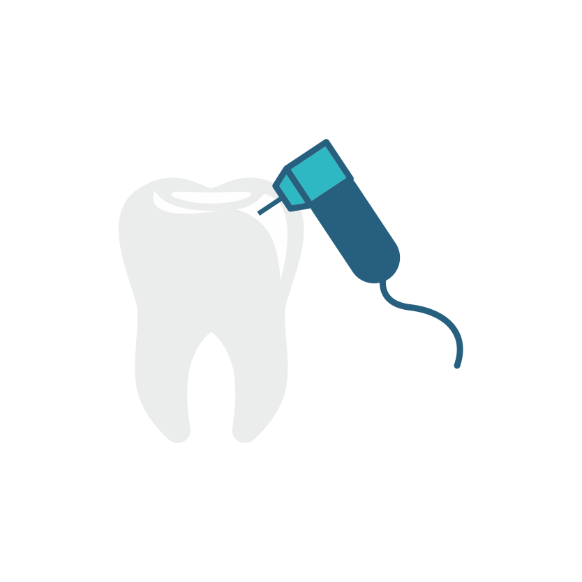 Endodontinis (dantų šaknų kanalų) gydymas