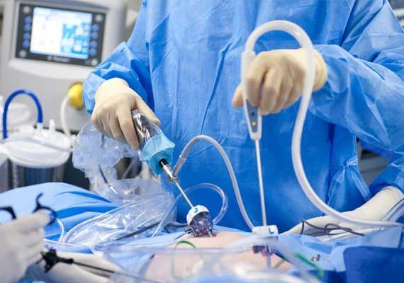 DR. ROGELIO LARA ZAVALA- cirugía laparascópica