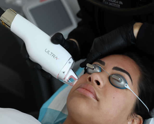 LaseMD Ultra Advanced Skin Rejuvenation in Orlando Windermere