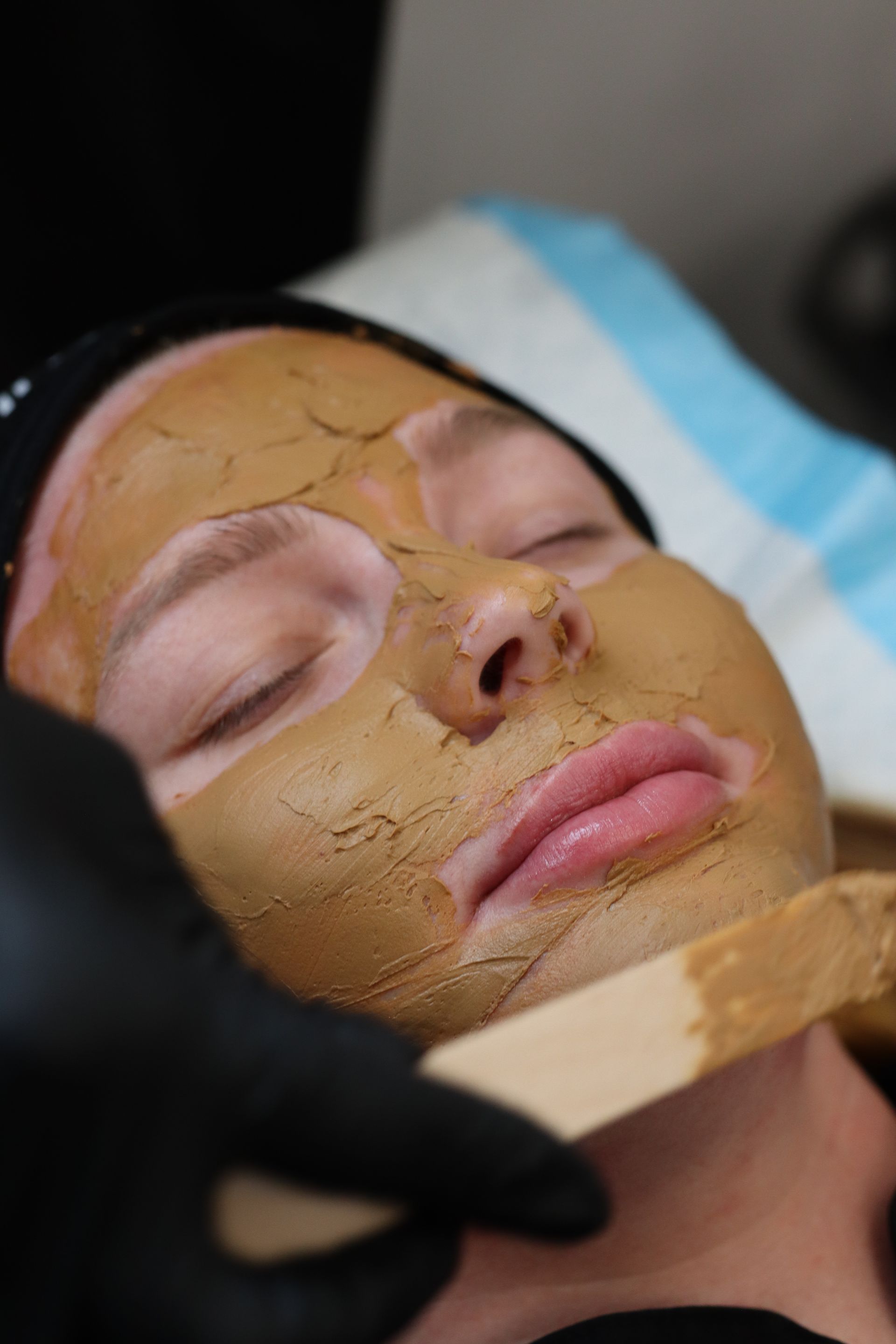 Client Receiving Professional Cosmelan Peel Application for Melasma and Hyperpigmentation at Windermere Medical Spa in Orlando - Expert Care in a Luxurious Setting for Enhanced Skin Radiance and Tone Correction