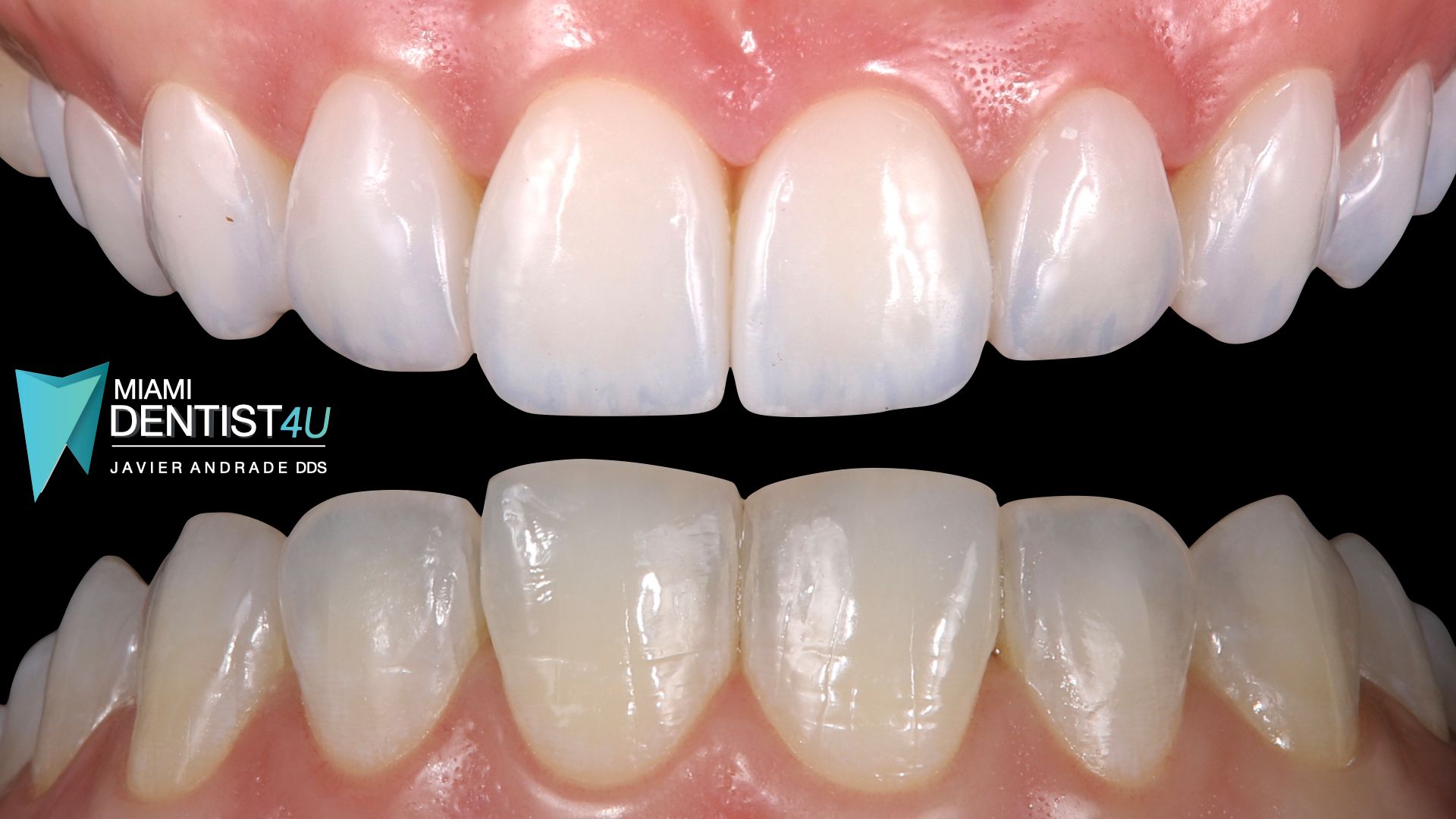A close up of a person 's teeth with a dentist4u logo in the background