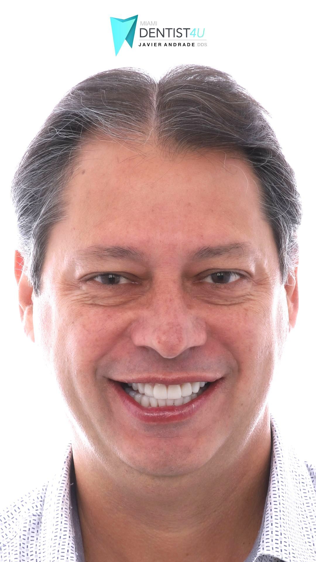 A close up of a man 's face with a smile on his face.
