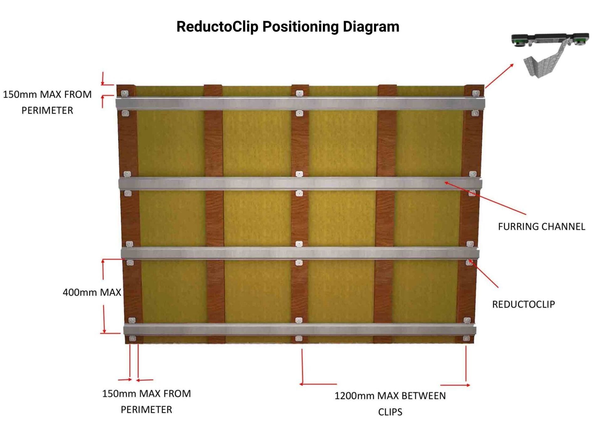 ReductoClip Positioning Diagram
