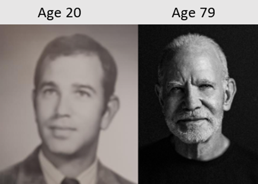 Before and After Old Age of Dr. Marc B Cooper