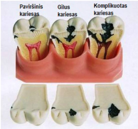 Terapinis suaugusių ir vaikų gydymas