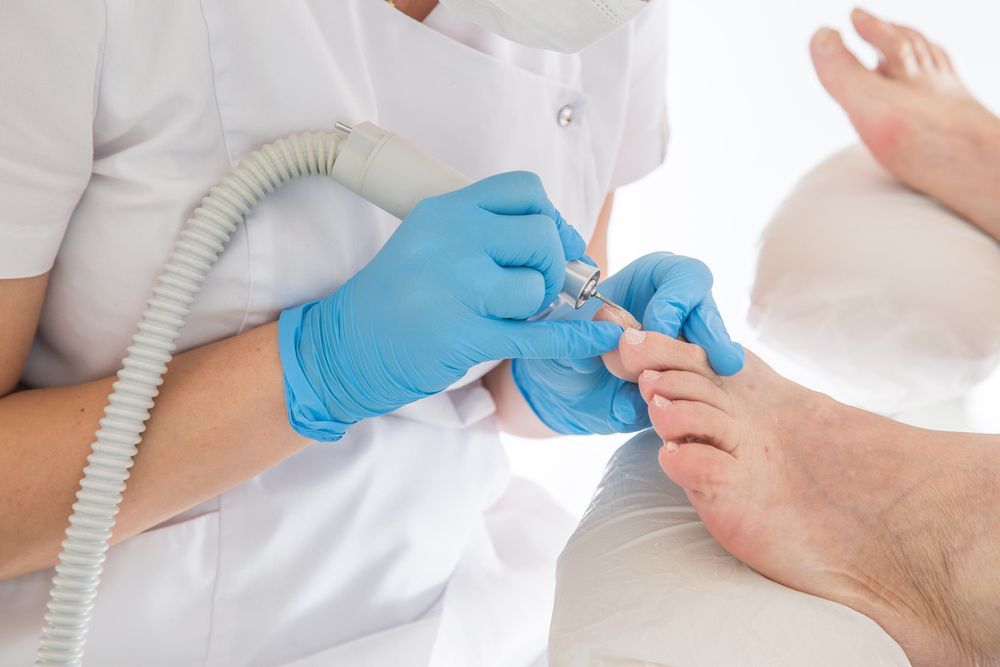 A Person Is Getting Their Toenails Done By A Nurse — Sandy Gugenberger Podiatrist in Port Macquarie, NSW