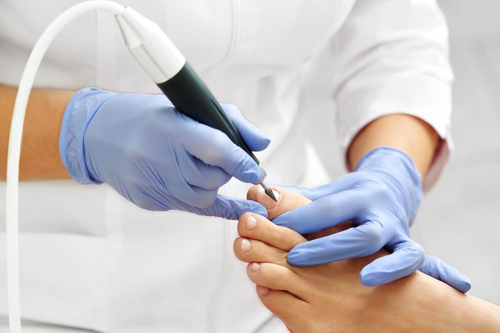 A Person Is Getting Their Toenails Done By A Nail Technician — Sandy Gugenberger Podiatrist in Port Macquarie, NSW