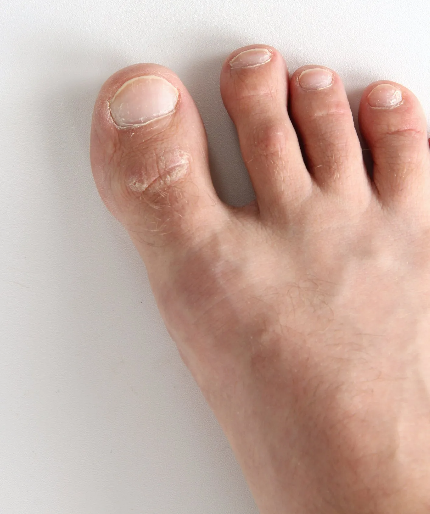 Stiff Big Toe — Garden City, NY — Megan Chapter D.O.