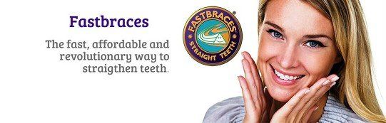 Fastbraces teeth