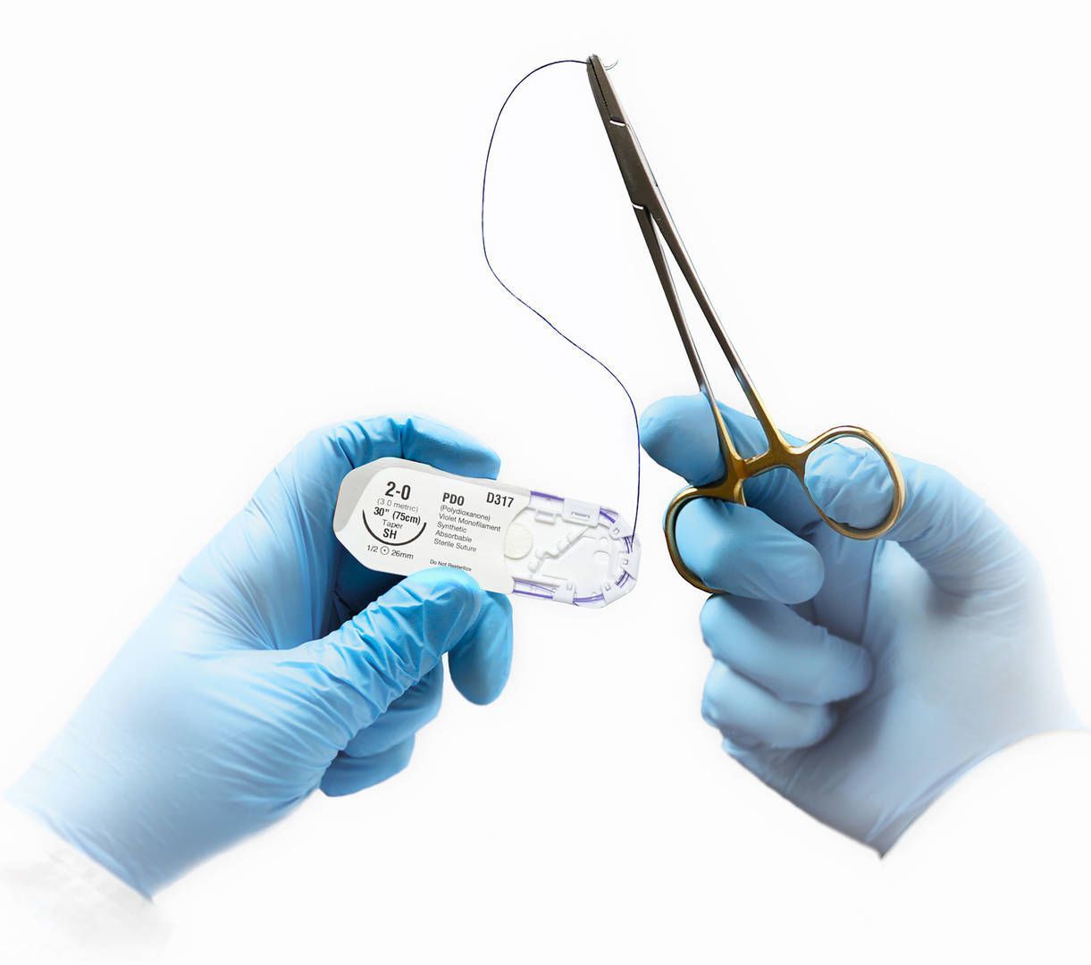 A person wearing blue gloves is holding a pair of scissors