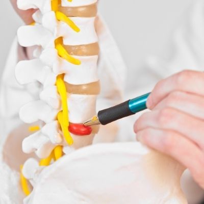 a person is holding a pen over a disc herniation
