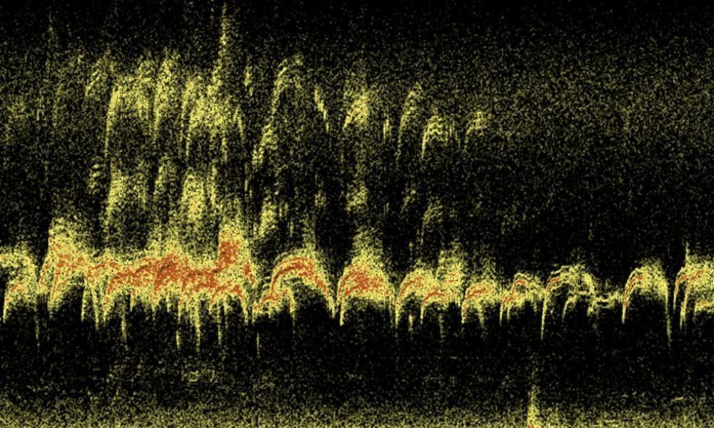 Acoustic Monitoring display