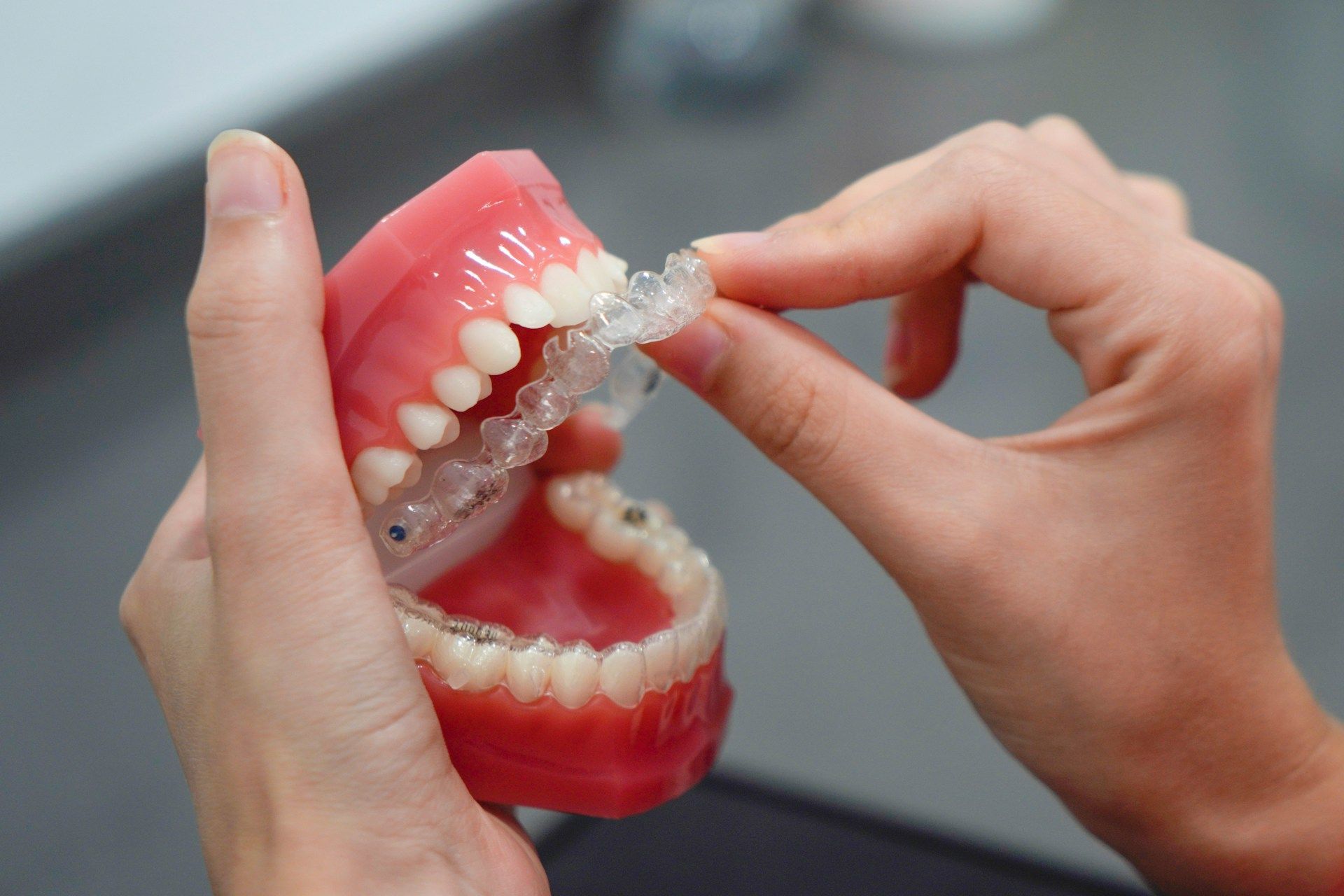 A person is holding a model of teeth with a clear Invisalign brace.