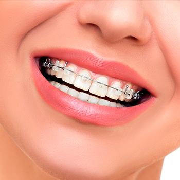 Ortodoncia y Odontología