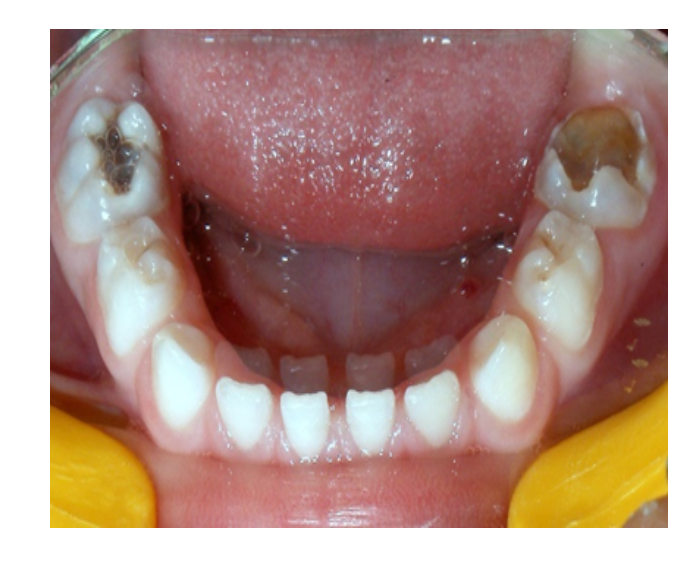 Odontología infantil