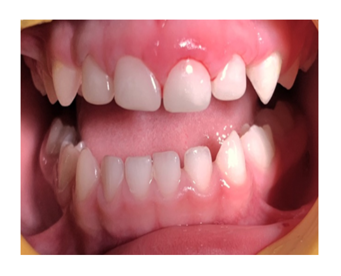 Odontología infantil