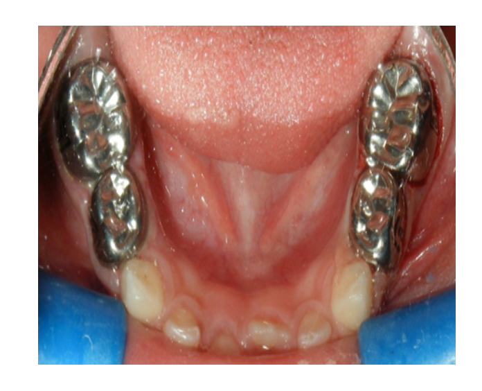 Odontología infantil