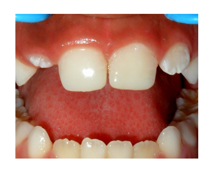 Odontología infantil