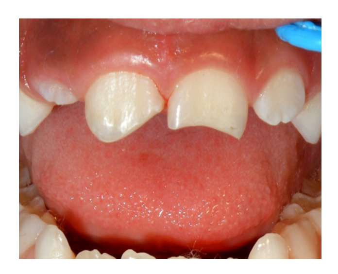 Odontología infantil