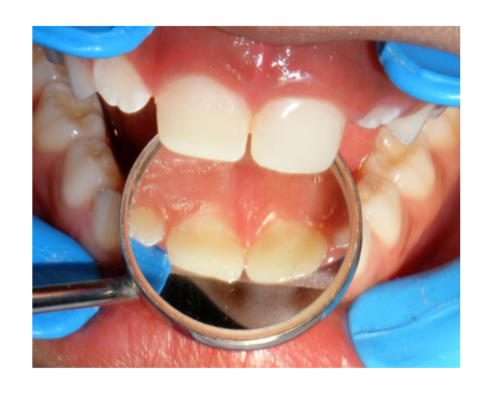 Odontología infantil