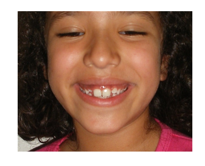 Odontología infantil