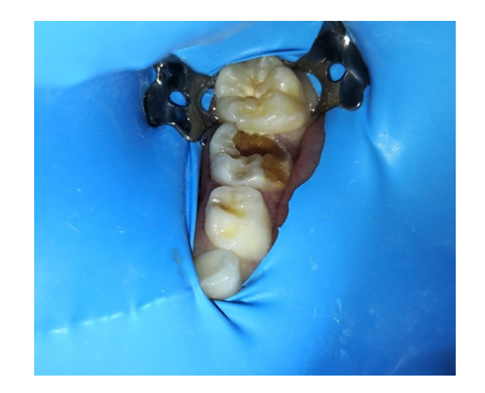 Odontología infantil