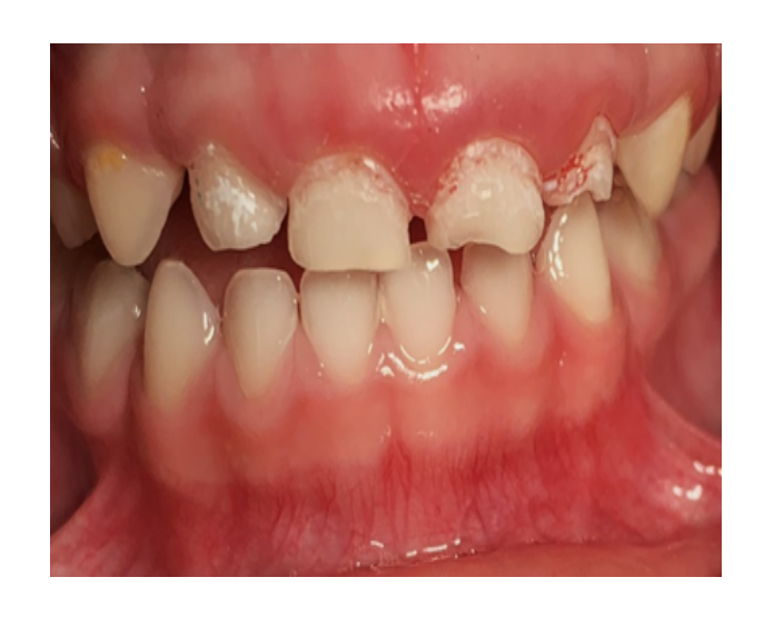 Odontología infantil