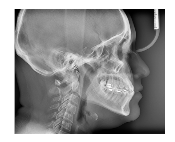 Tomógrafo Dental Ray Scan