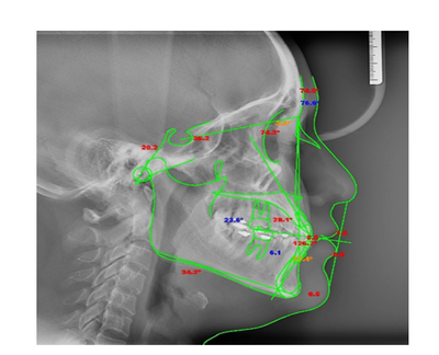 Tomógrafo Dental Ray Scan