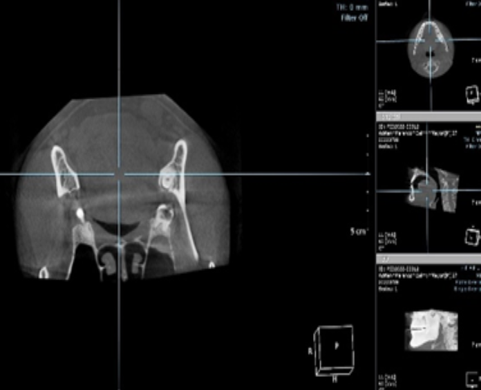 Tomógrafo Dental Ray Scan
