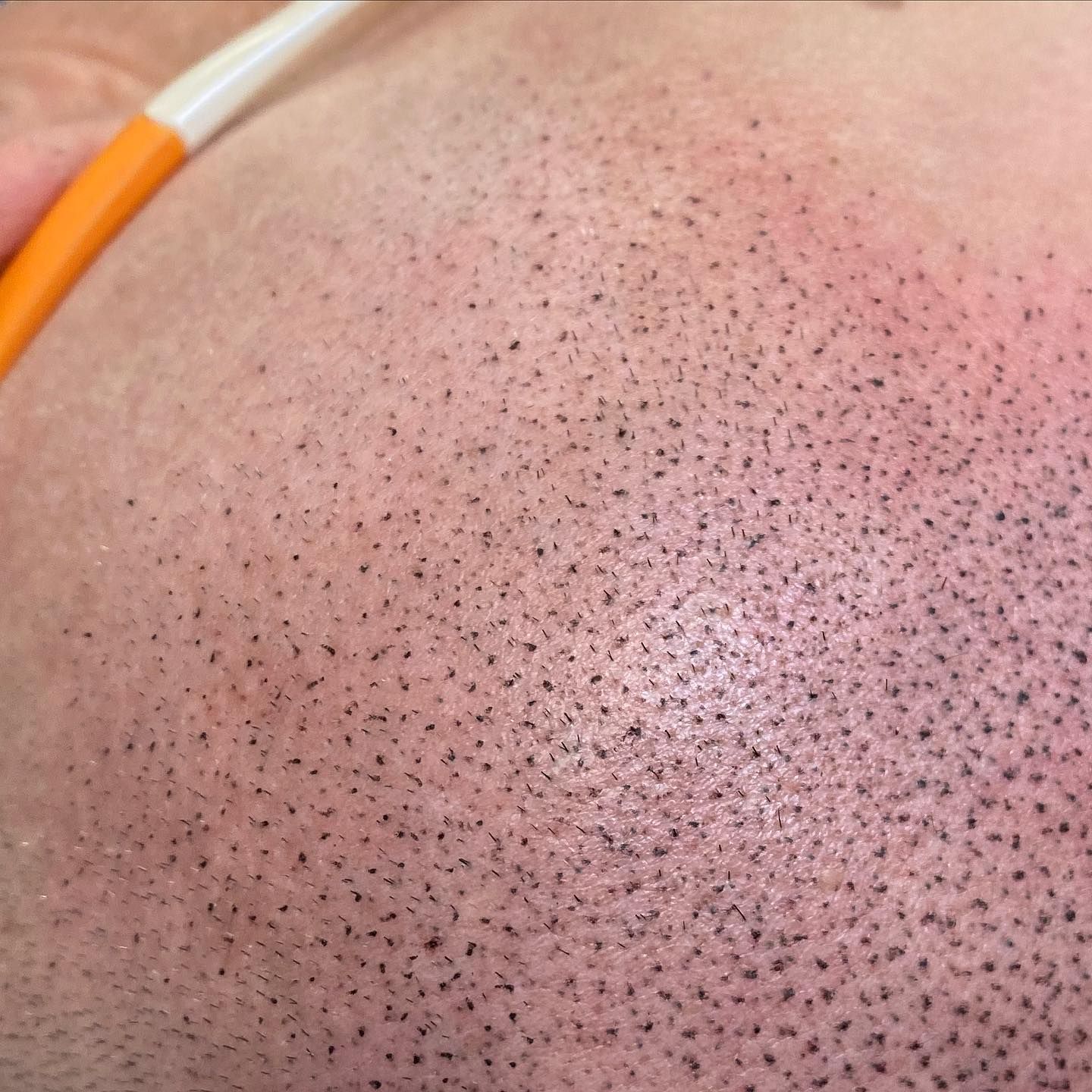 A close up of a person 's face with a pencil in it