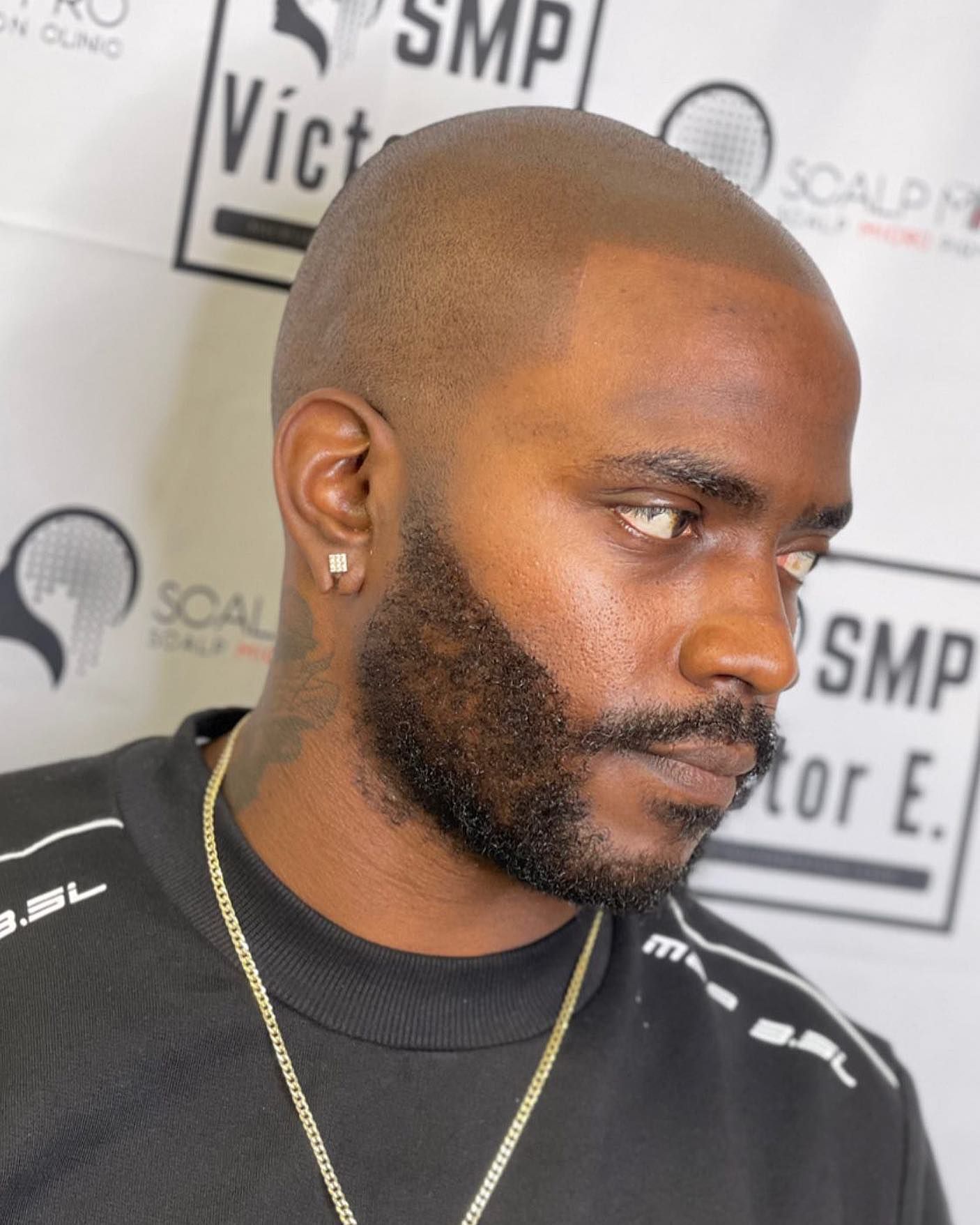 A man with a beard is wearing a black shirt with the word scalp on it