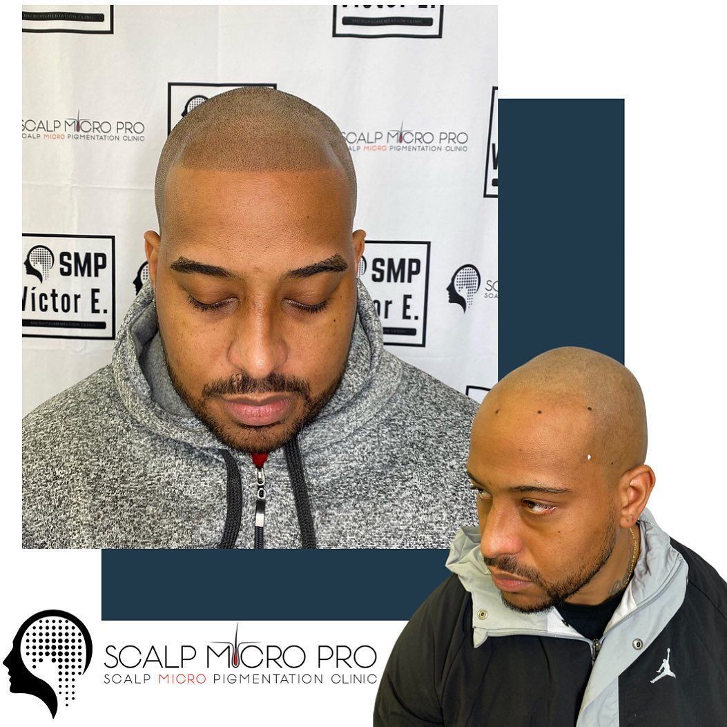 A man with a shaved head and a beard is wearing a gray jacket.