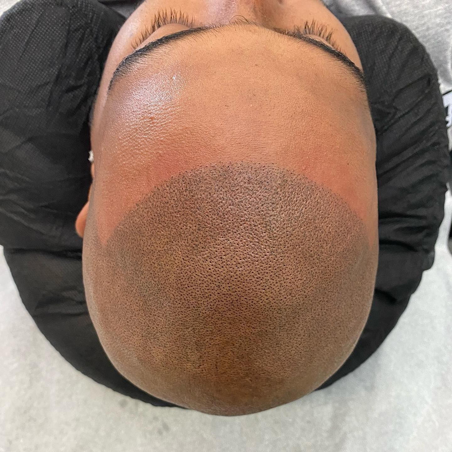 A man with a shaved head is laying down with his eyes closed