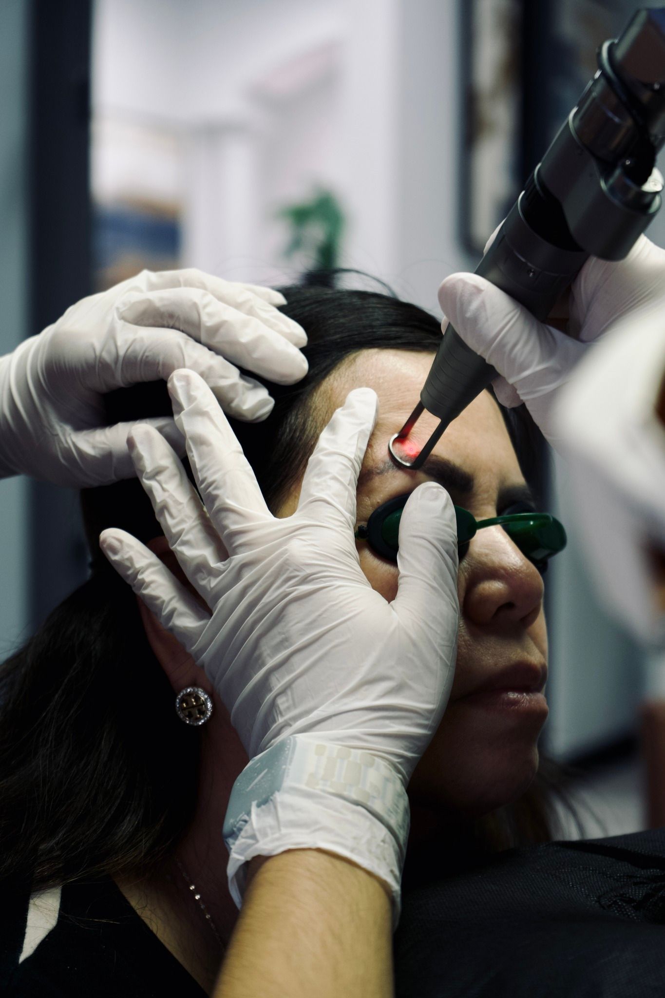 A woman is getting a laser treatment on her eyebrows