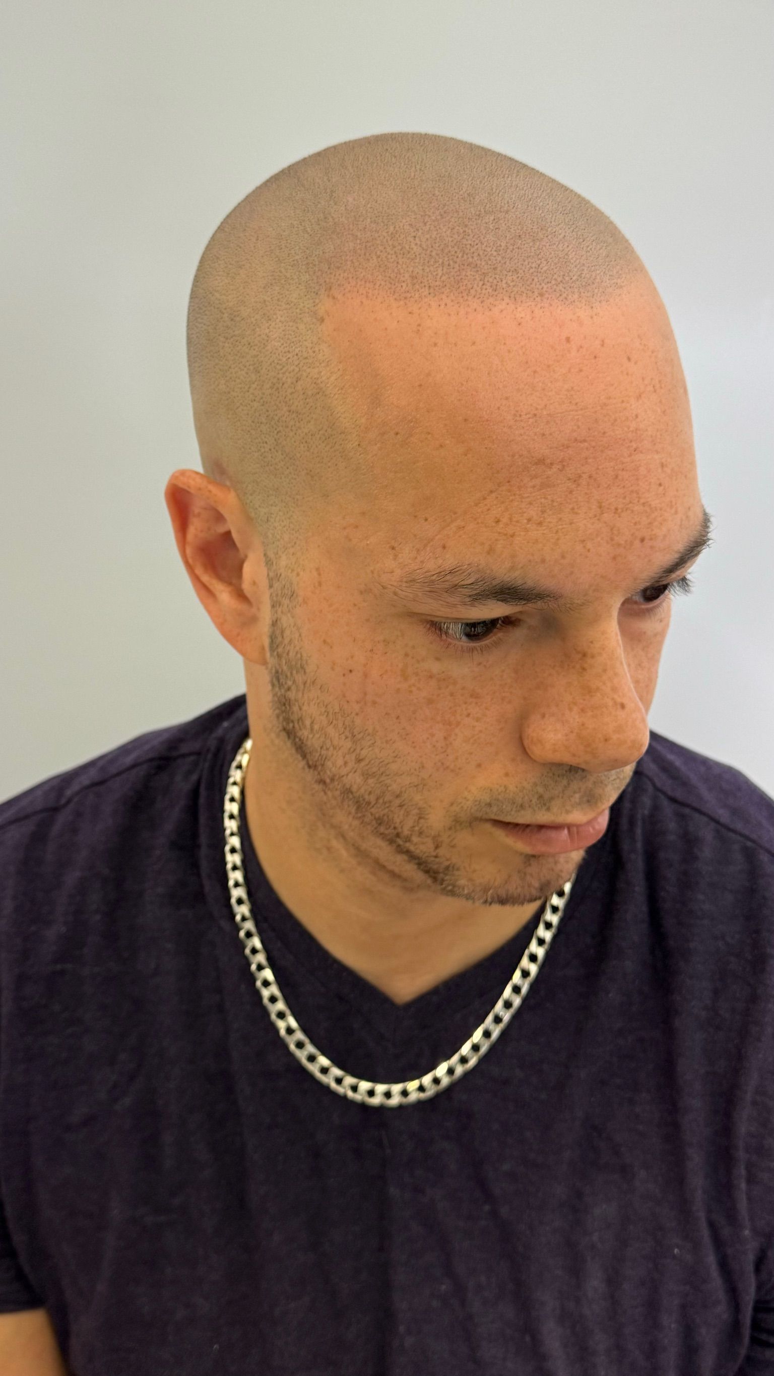 A man with a shaved head wearing a chain around his neck