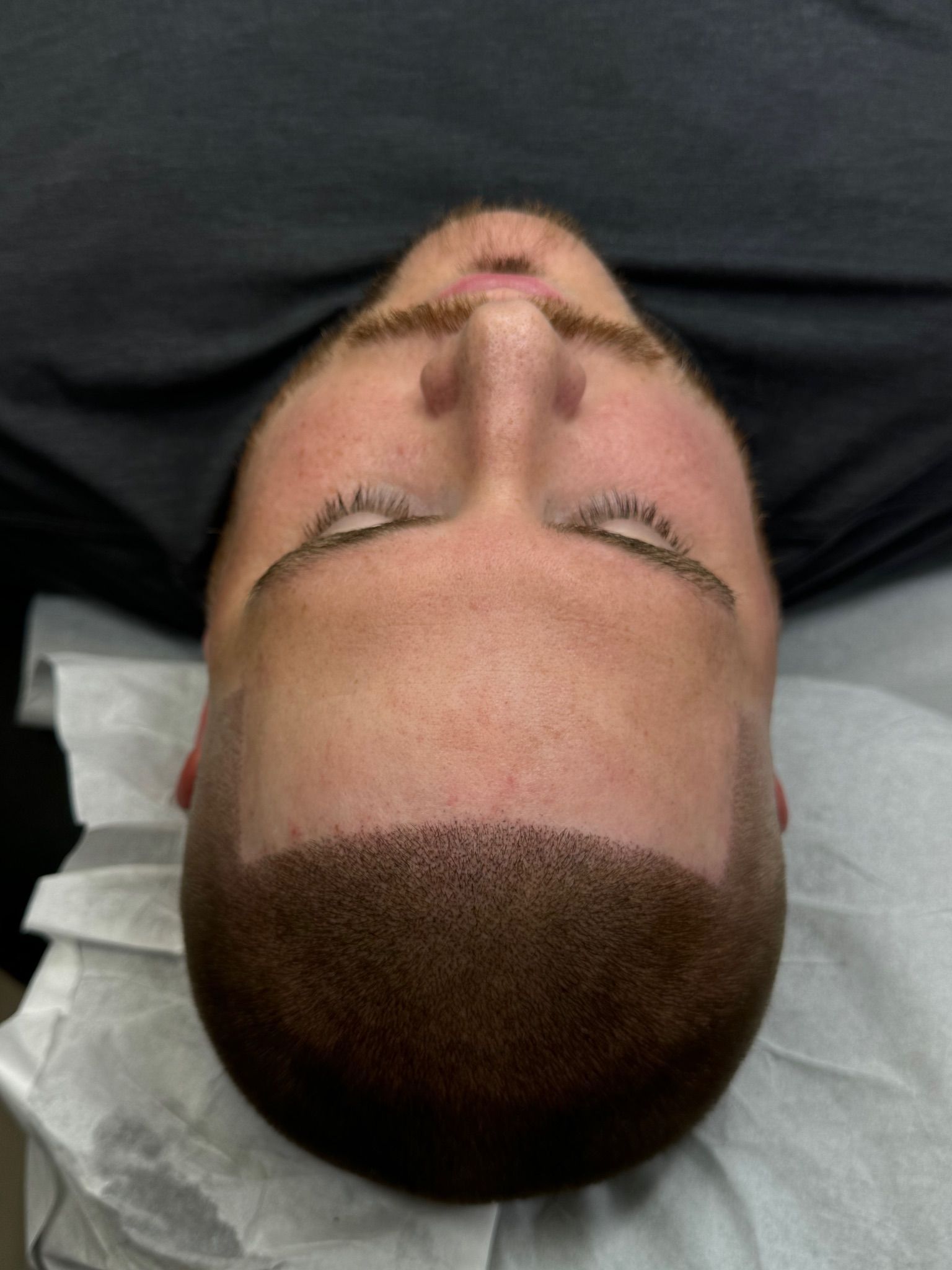 A man with a shaved head is laying on a table with his eyes closed.