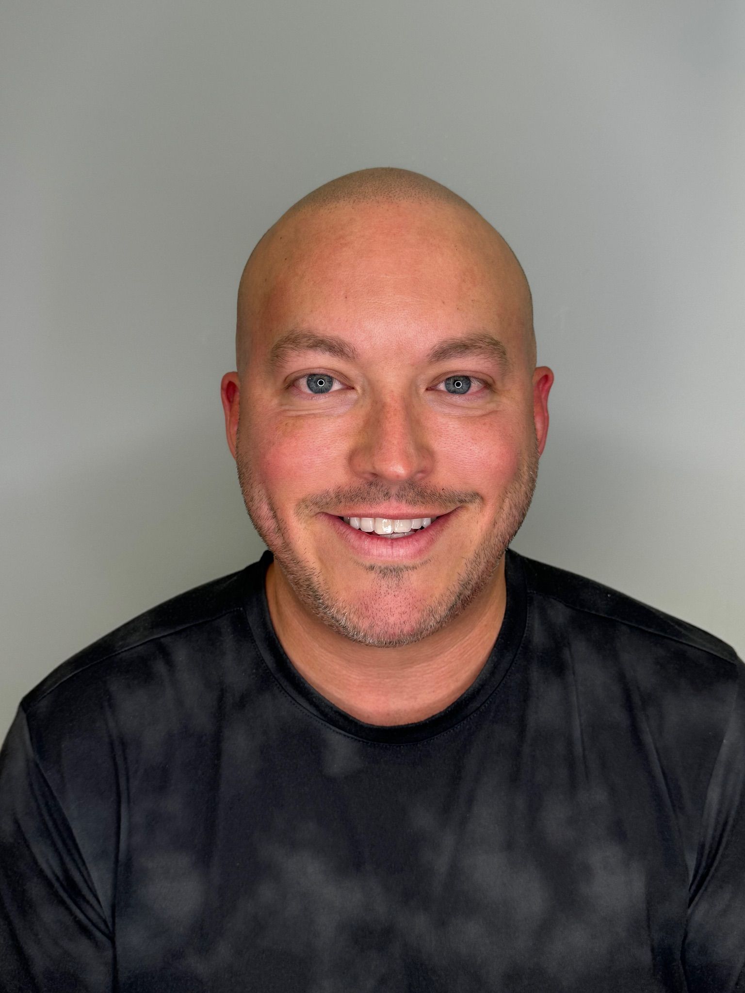 A bald man with a beard is smiling for the camera while wearing a black tie dye shirt.